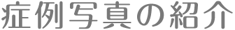 症例写真のご紹介